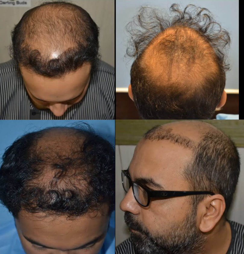7 Things Hair Clinics Won’t Tell You… Until It’s Too Late
