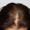 Patient 3
